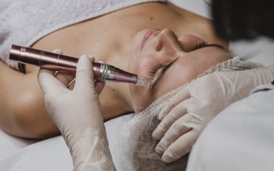 Tips to Prepare for a Micro Needling Session