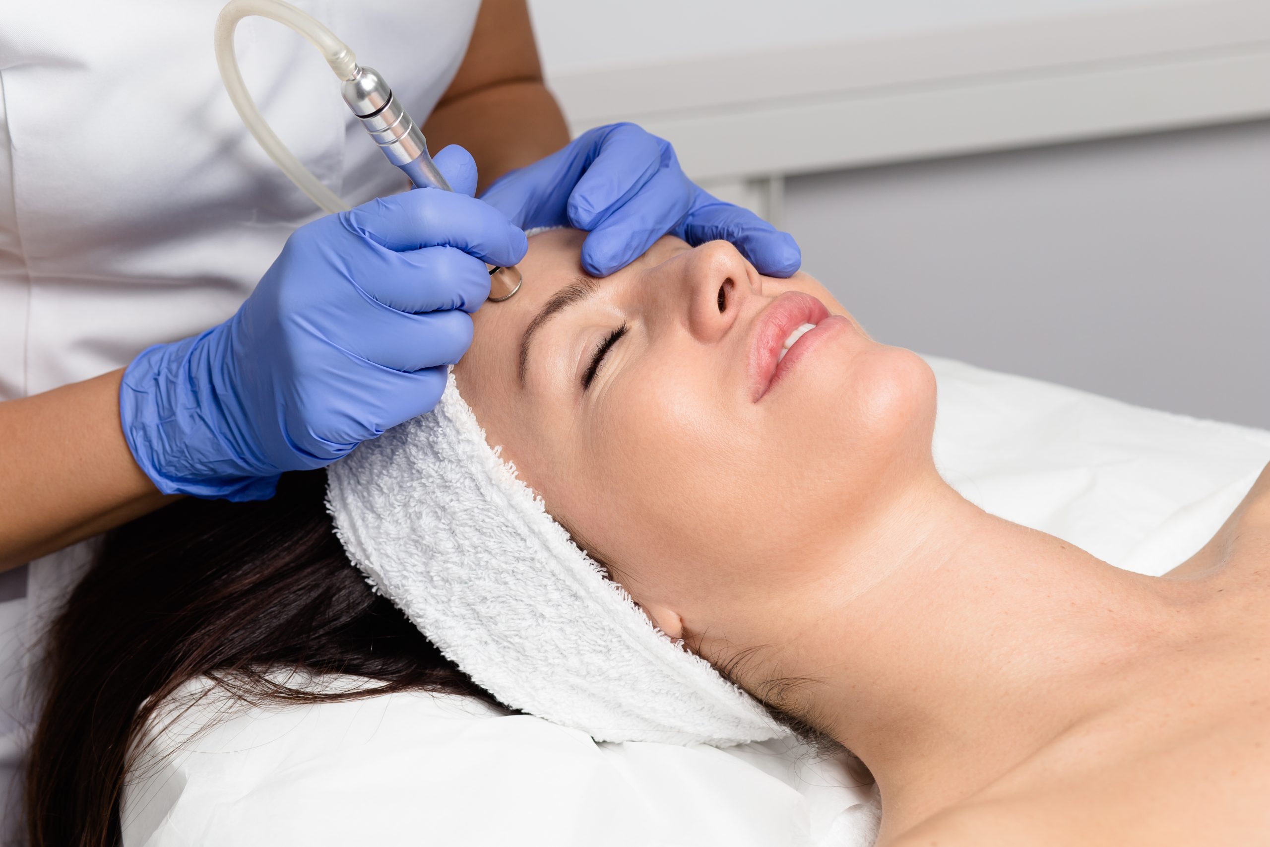Microdermabrasion treatment at Le Caprice Medical Spa in Orinda CA
