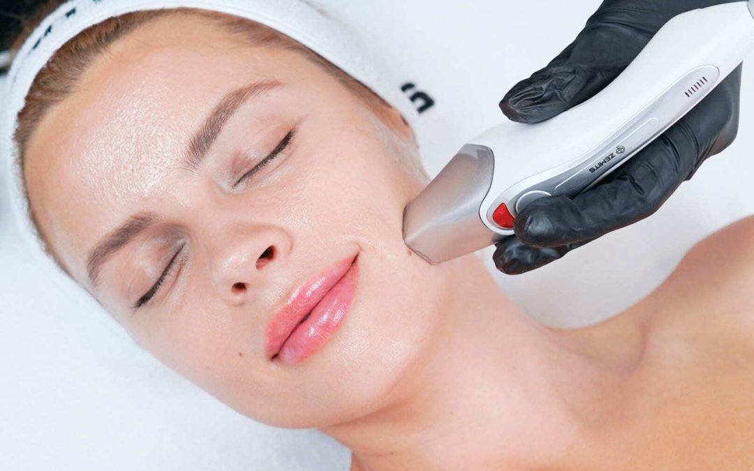 CrystalFrax RF skin resurfacing treatment at Le Caprice Medical Spa Orinda CA